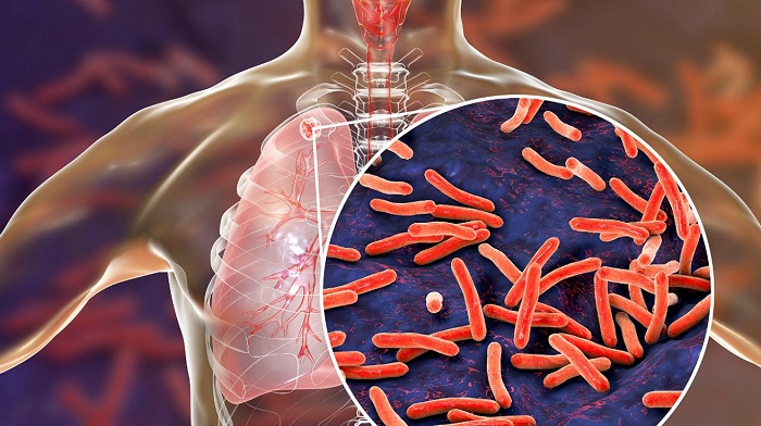 trái cây tốt cho người bệnh lao phổi