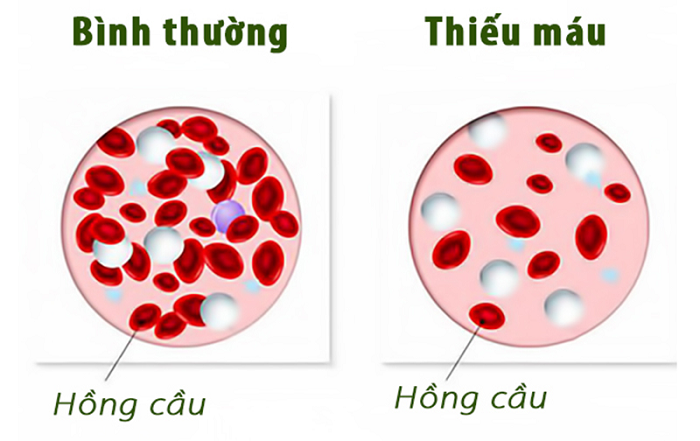 trái cây tốt cho người thiếu máu
