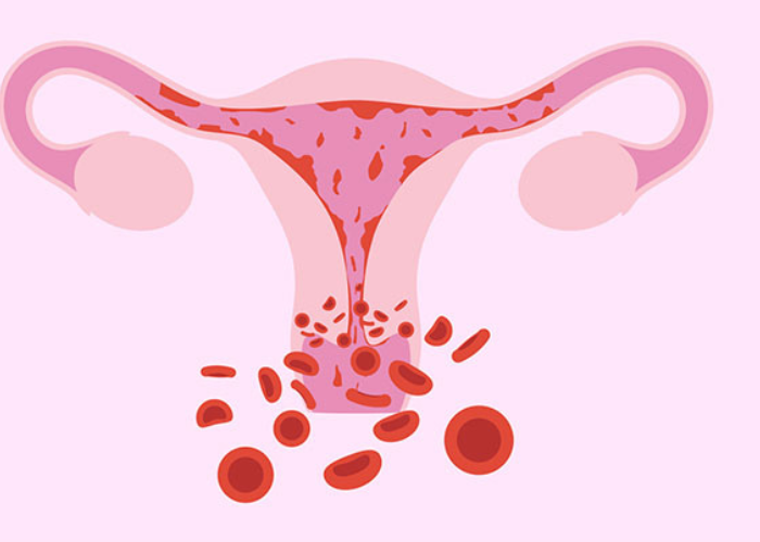 kinh nguyệt sớm 15 ngày